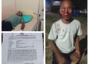 Senggeta Soal Mikrofon Berujung Pengeroyokan, Warga Siantar Lapor Polisi