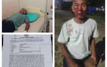 Senggeta Soal Mikrofon Berujung Pengeroyokan, Warga Siantar Lapor Polisi